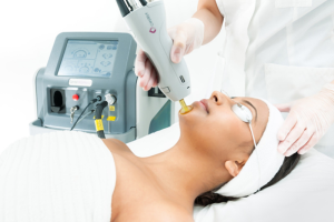 hairremoval_img004